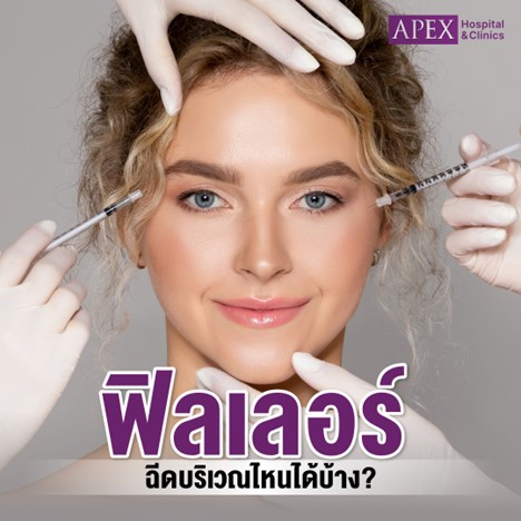 ฟิลเลอร์ฉีดตรงไหนได้บ้าง