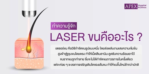Laser ขน
