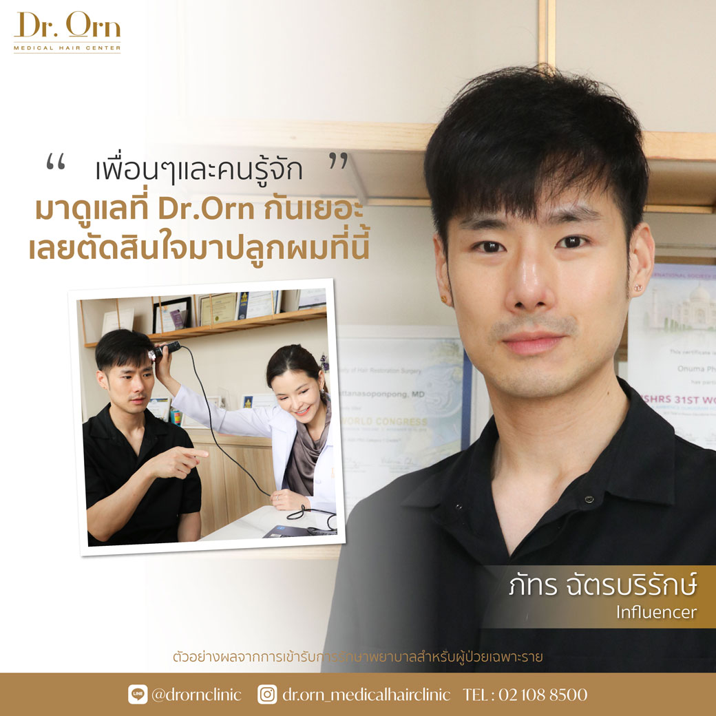  รีวิวปลูกผม     