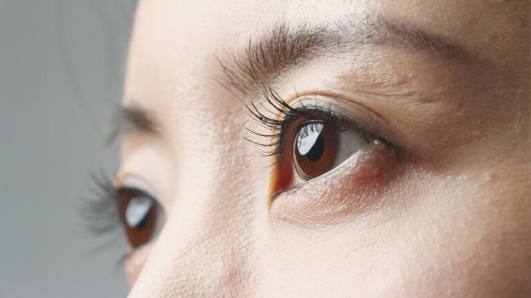 การแก้ตาคืออะไร