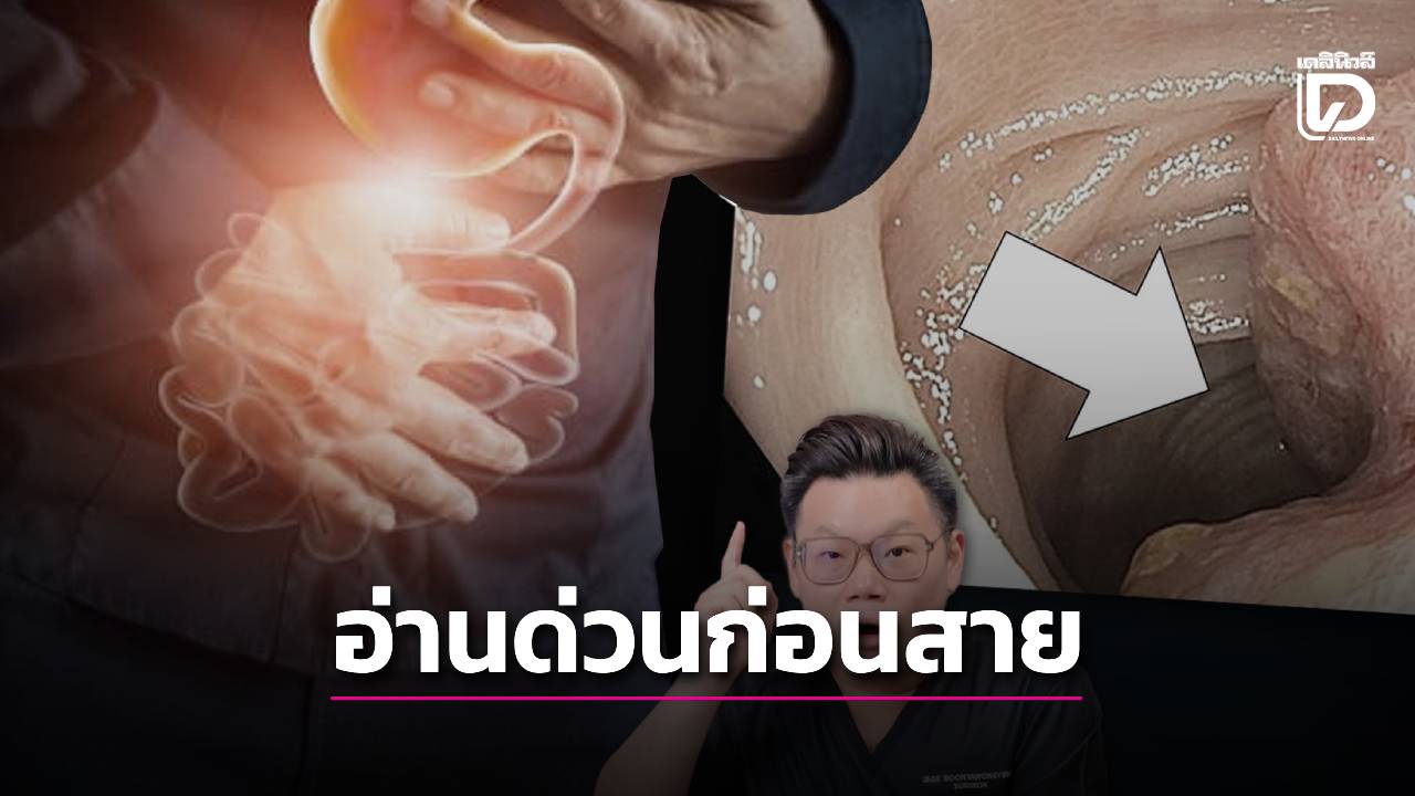 .อย่าปล่อยผ่าน! หมอเจดเปิด 5 “ฆาตกรเงียบ” ในลำไส้! ใครท้องผูกเรื้อรัง-กินหวานจัดทุกวัน อ่านด่วนก่อนสาย.