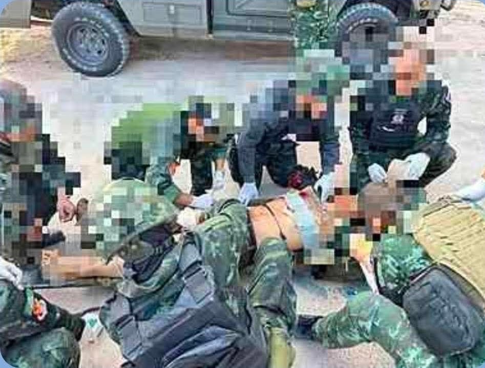 .พลทหารไทยเสียชีวิตเพิ่ม 1 นาย ถูกสะเก็ดระเบิดแขน-ขาขวา.