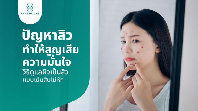 สิว
