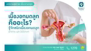 เนื้องอกมดลูก