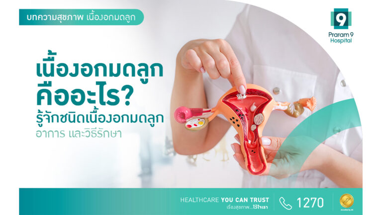 เนื้องอกมดลูก