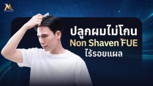 ปลูกผมไม่โกน (non shaven)