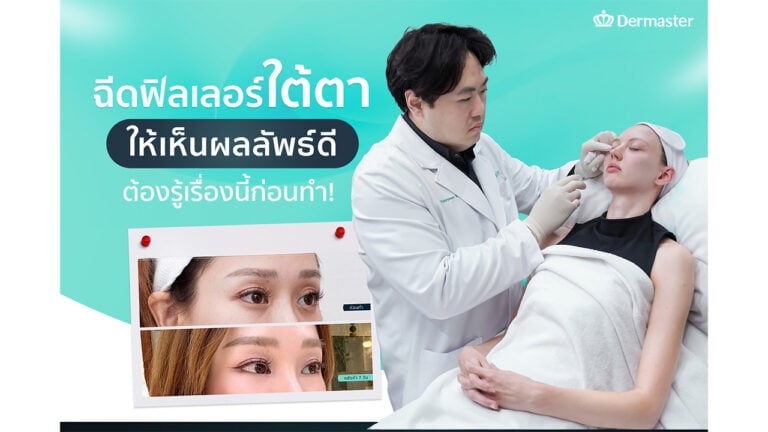 ฉีดฟิลเลอร์ใต้ตา