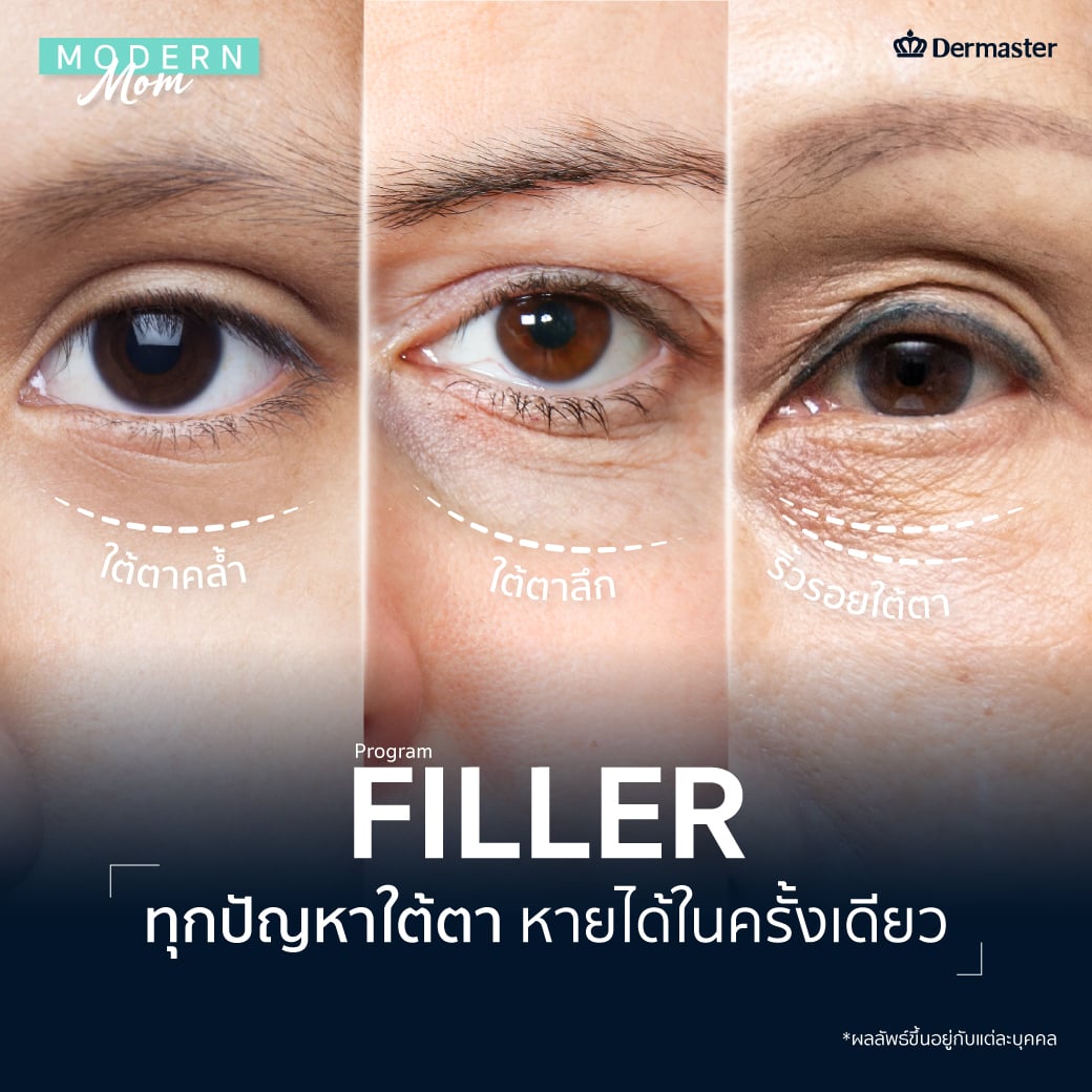 ฟิลเลอร์ใต้ตา ประโยชน์