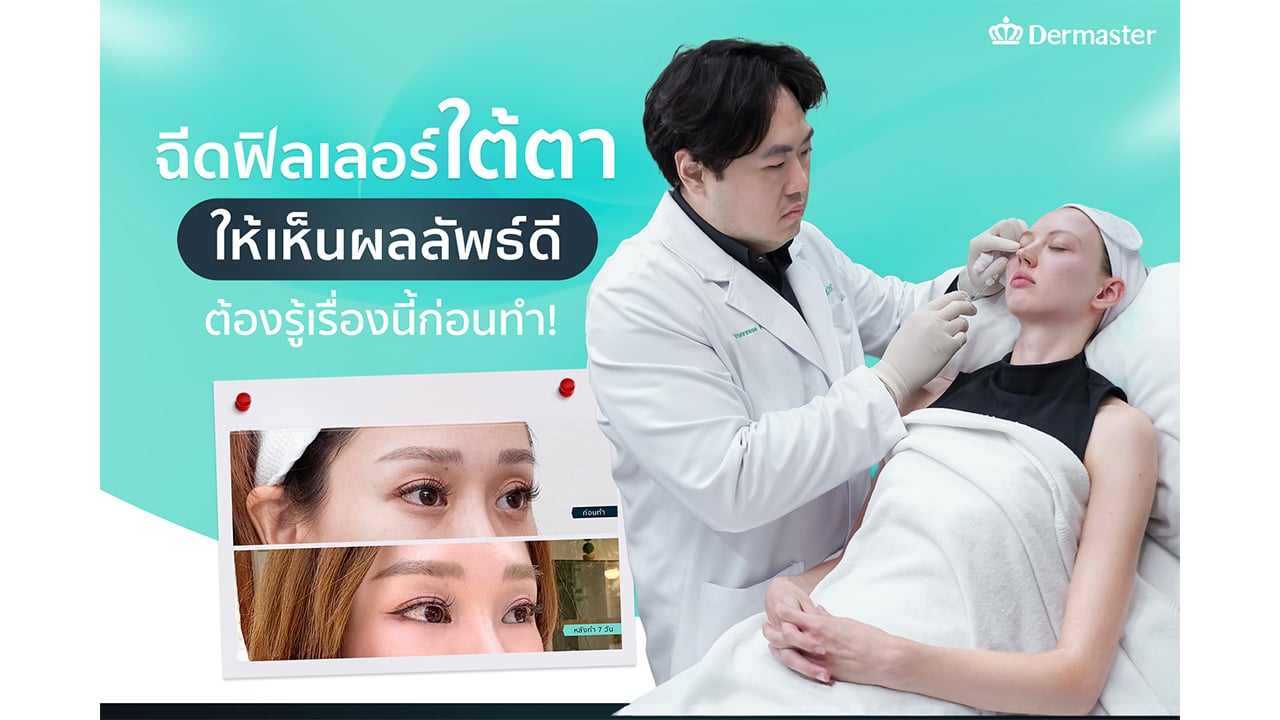 ฉีดฟิลเลอร์ใต้ตา