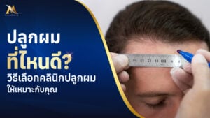 ปลูกผมที่ไหนดี