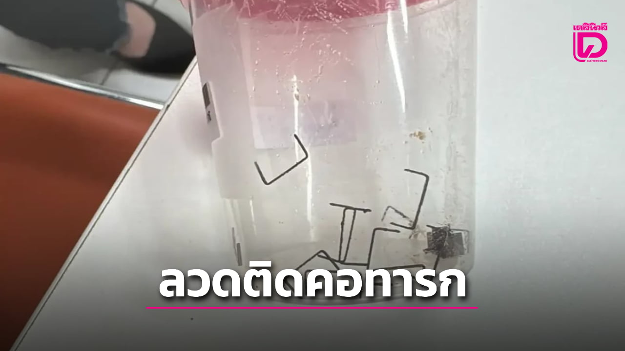 อุทาหรณ์! เร่งผ่าตัดทารกวัย 6 เดือน หลังพบลวดเย็บกระดาษค้างอยู่ในคอ