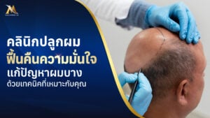 คลินิกปลูกผม