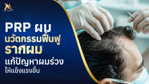 ปลูกผม