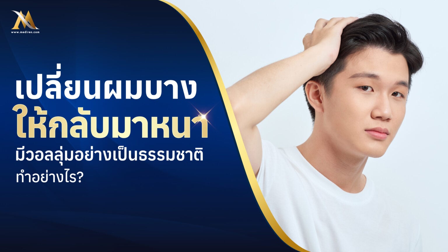 ผมบาง